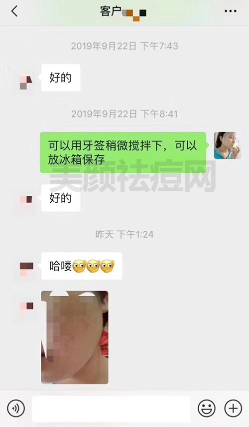 脸上怎么消痘印