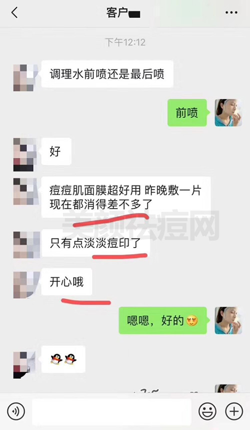 脸上祛痘面膜哪款好