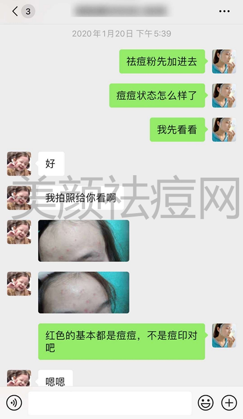 祛痘什么产品好用反馈