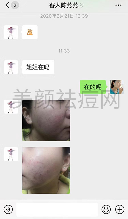 反馈效果7