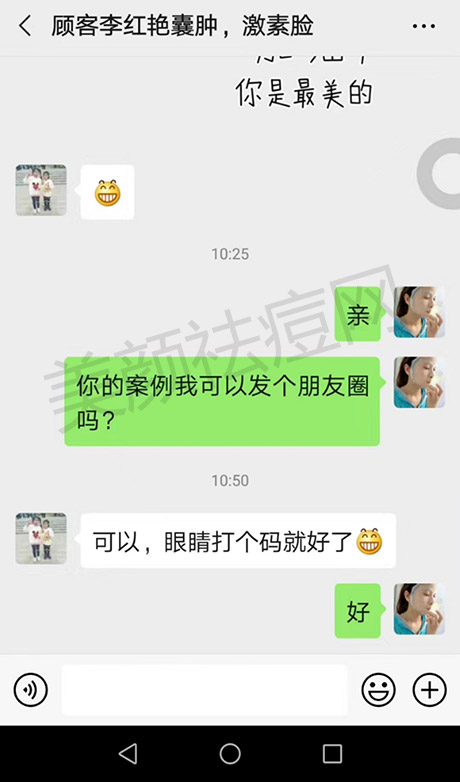 囊肿激素脸反馈调理6