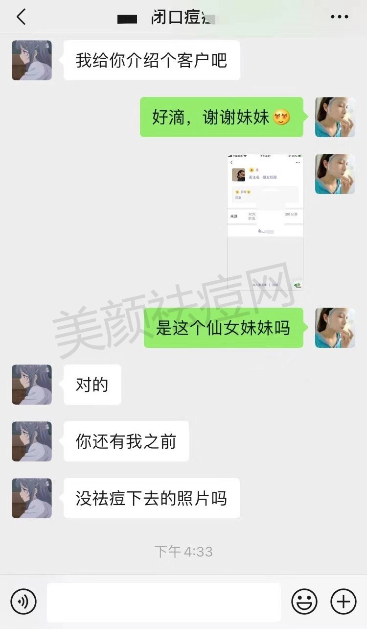 脸上不停的长粉刺痘痘怎么根治去除分享